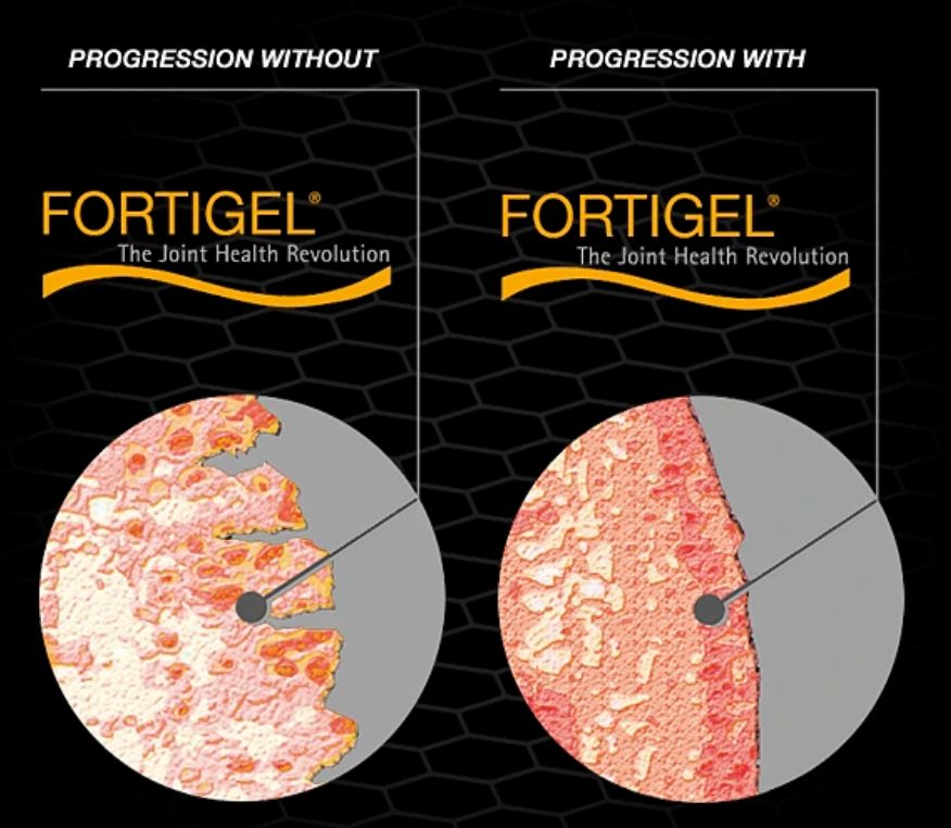 FORTIGEL® – Stavitel vašich chrupavek